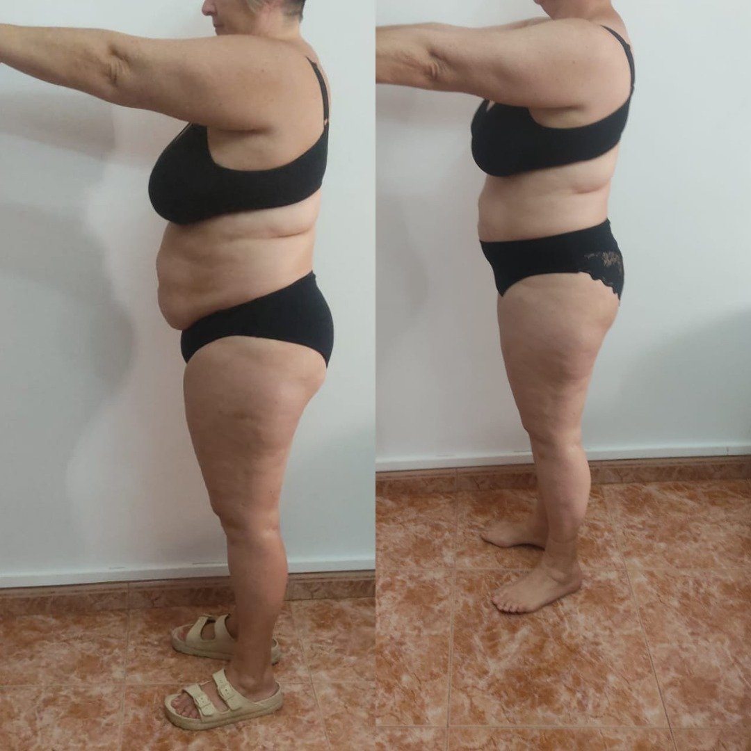Transformación 11